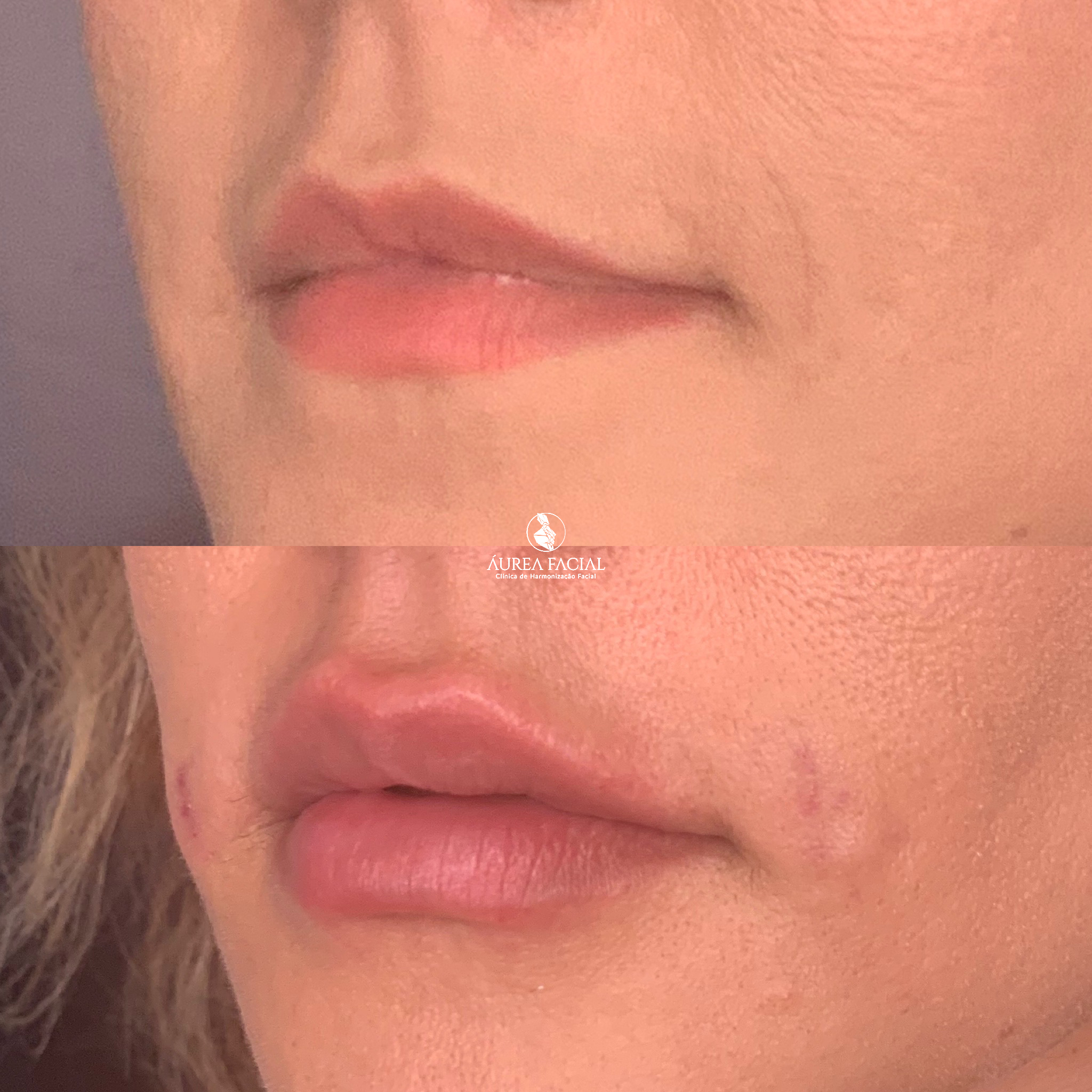 clinicaaureafacial_1710964621539