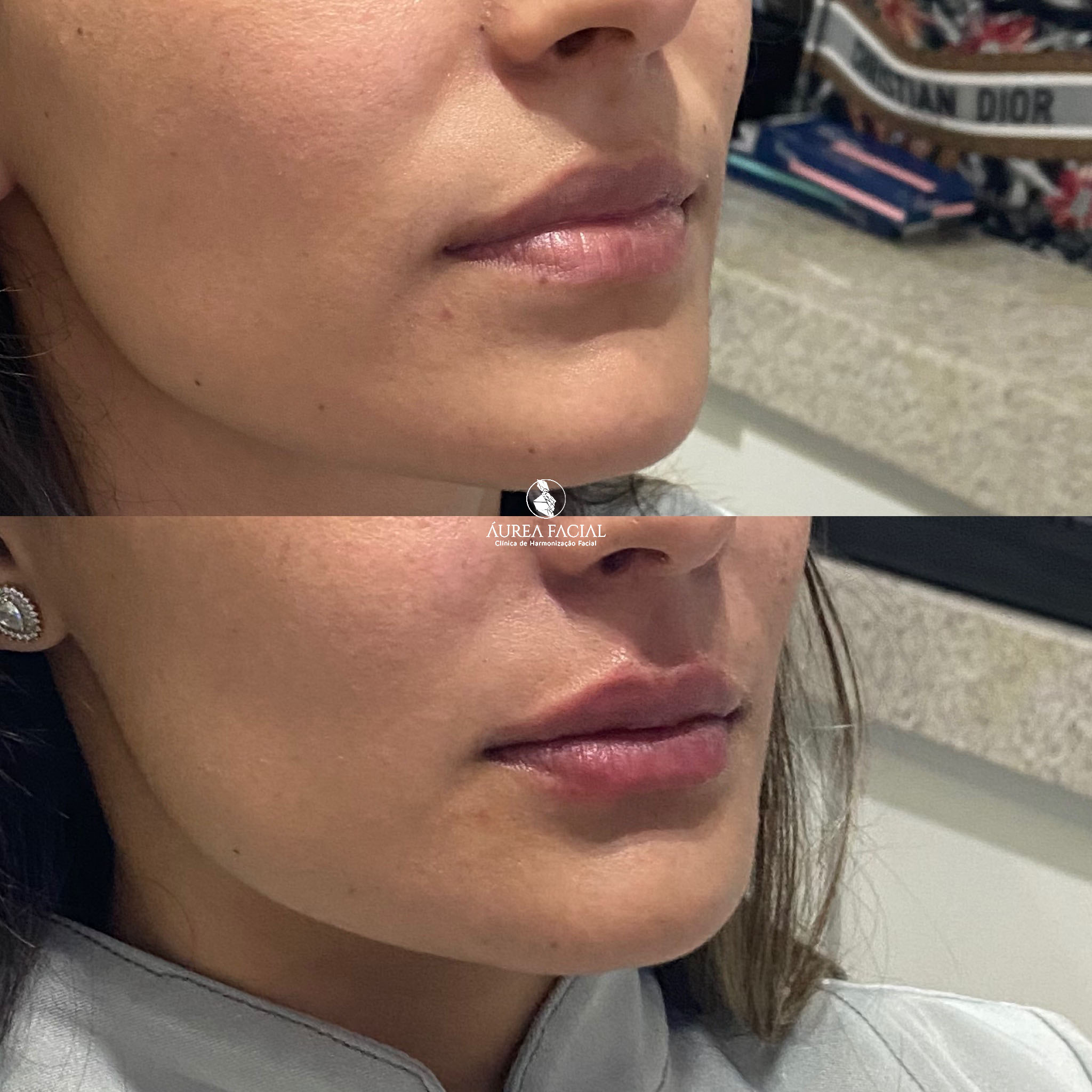clinicaaureafacial_1710964636548