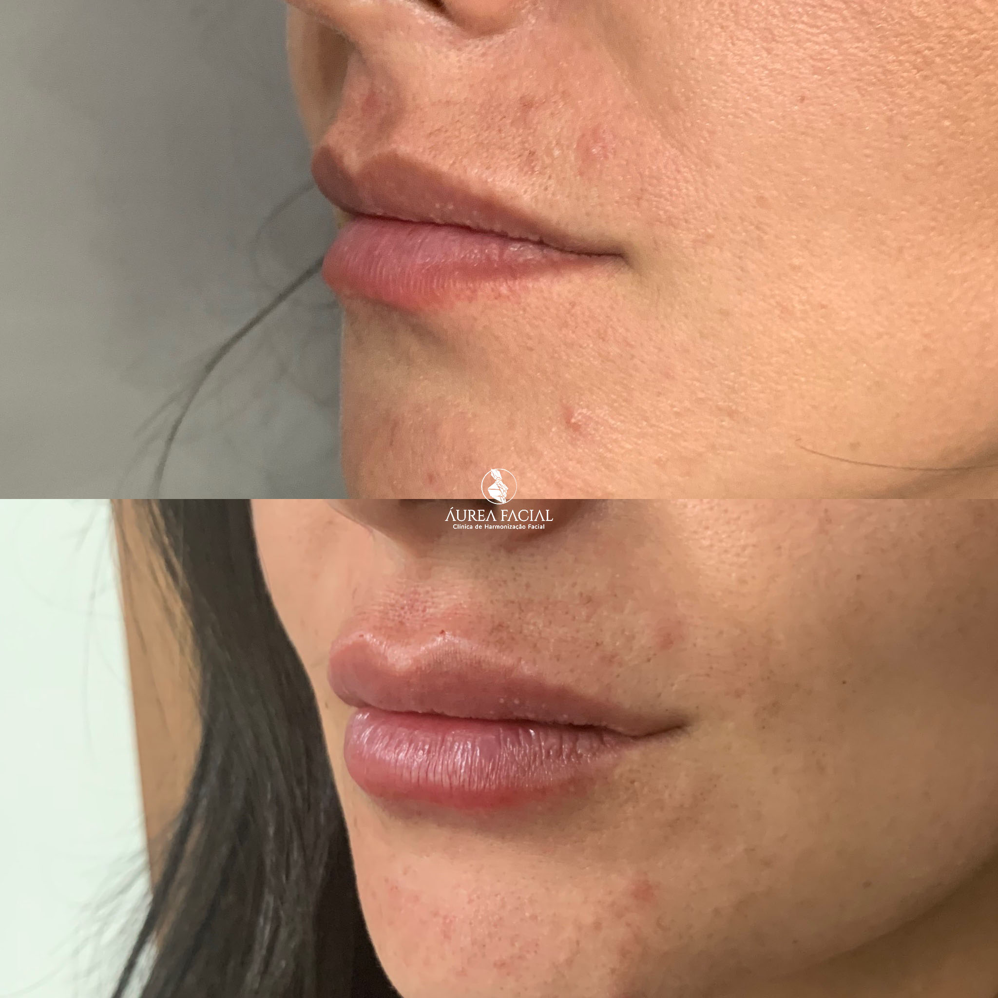 clinicaaureafacial_1710964663169