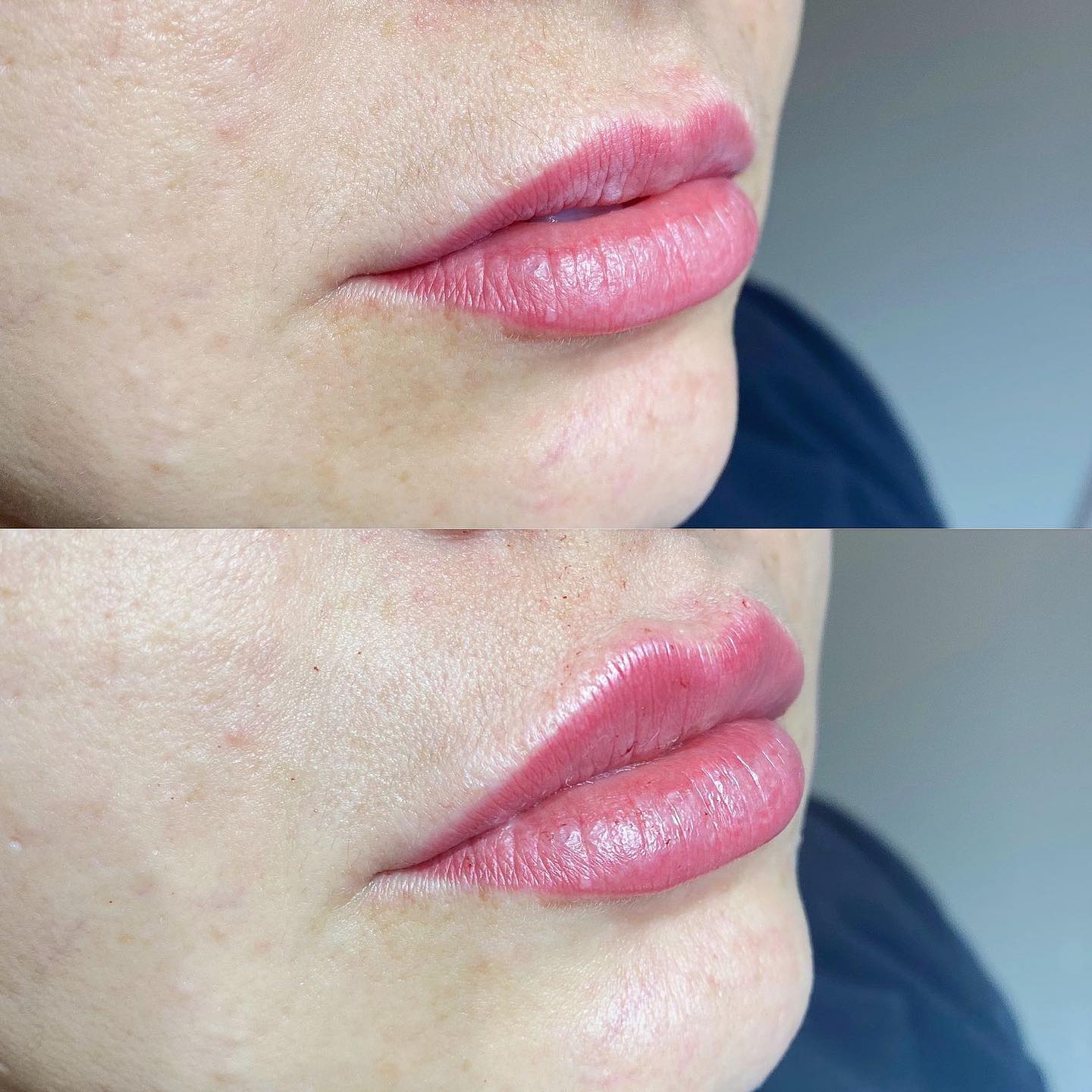 clinicaaureafacial_1710964685723