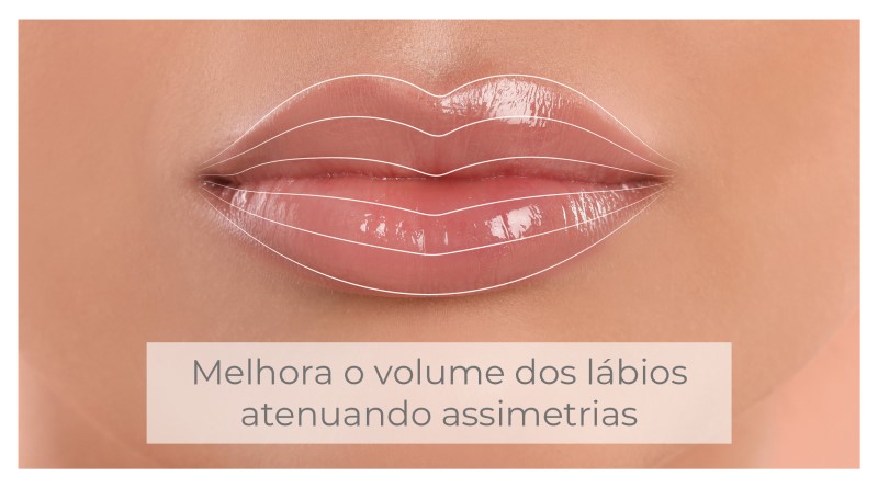 preenchimento-4